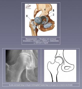 Het gezonde heupgewricht